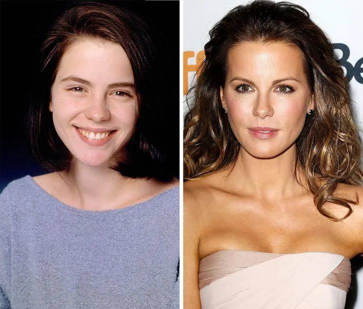 The beautiful Hollywood star was once just a normal looking girl(1)